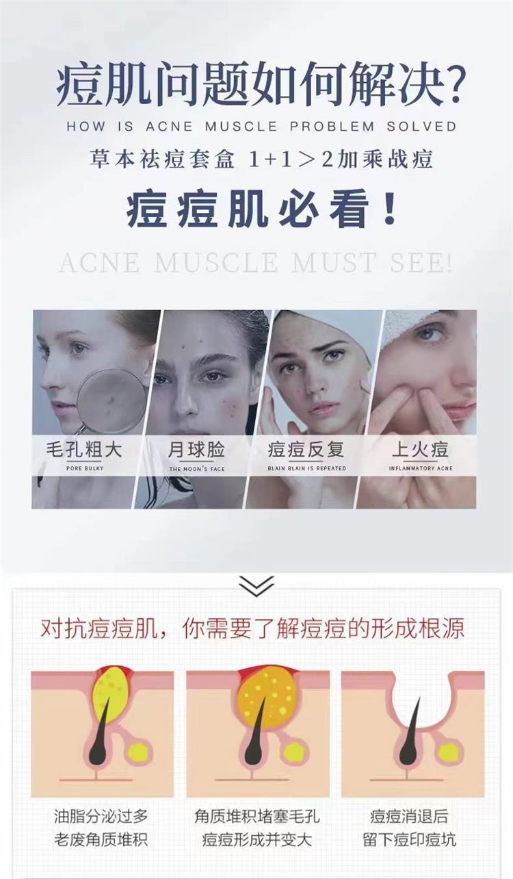 澳丽本草本祛痘系列(30ML×2)08.jpg